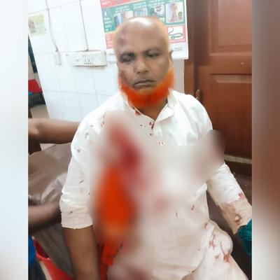 সাতকানিয়ার ধারালো অস্ত্র নিয়ে বিএনপির দুই পক্ষের সংঘর্ষ, ৮ নেতা-কর্মী আহত